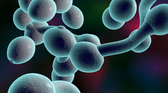 Killing of Candida auris by UV-C: Importance of exposure time and distance